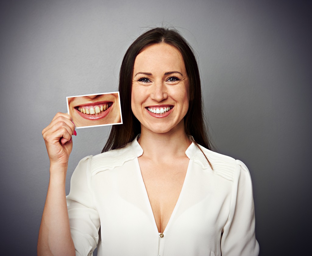 cosmetic dentistry by Jeffrey Ellenberg DMD PA in clearwater