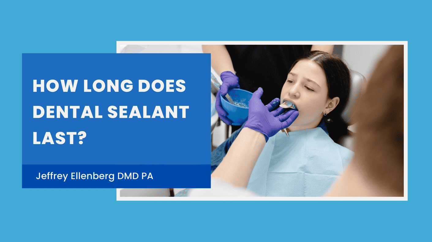 How Long Does Dental Sealant Last?