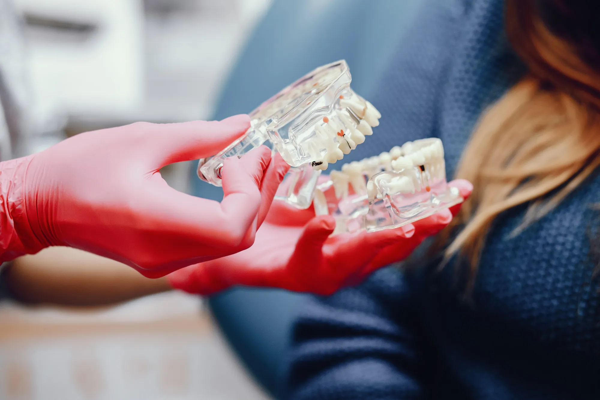 Dental Impressions